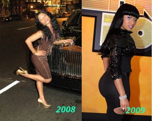Nicki Minaj Booty Before and After
